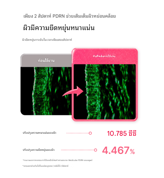 มาส์คกาว Medicube PDRN Pink Caffeine Night Wrapping Mask 75ml - Image 4
