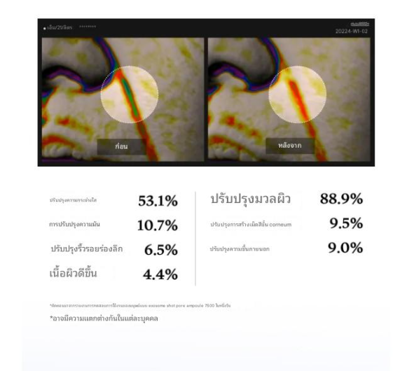Medicube One Day Exosome Shot 7500 30 ml - Image 4