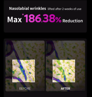 Dr. Melaxin Face Phalt Tightening Cream 50ml - Image 2