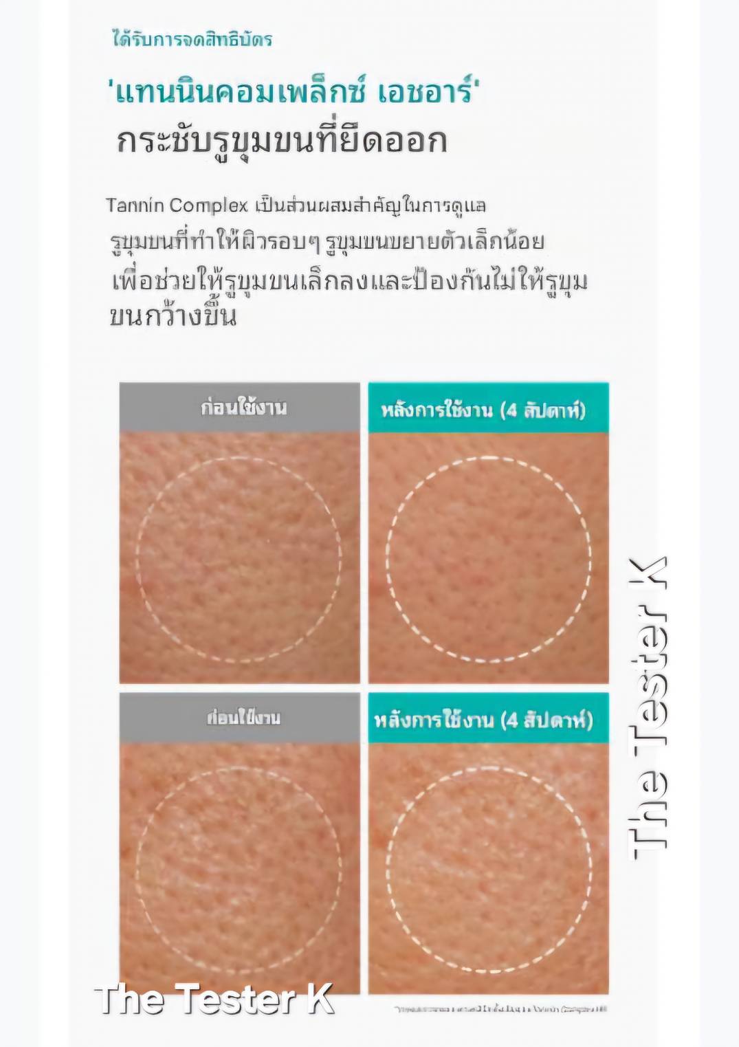 Dr. Melaxin BP Pore Clear Masks 25g 5 แผ่น มาส์ก– กระชับรูขุมขน + ลดริ้วรอย + ผิวกระจ่างใส - Image 8