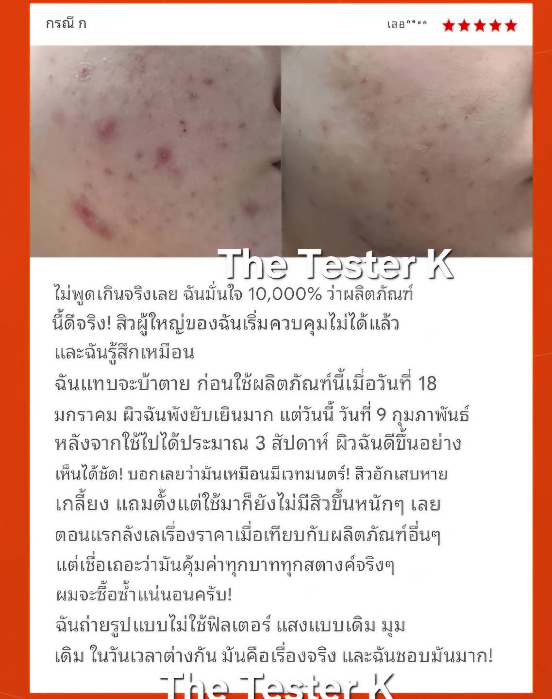 Dr.Melaxin Exosome Repair Peeling Serum 50ml - Image 3