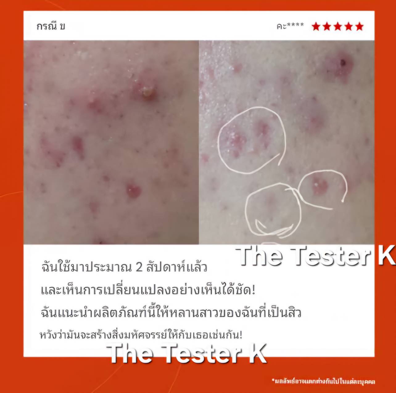 Dr.Melaxin Exosome Repair Peeling Serum 50ml - Image 4