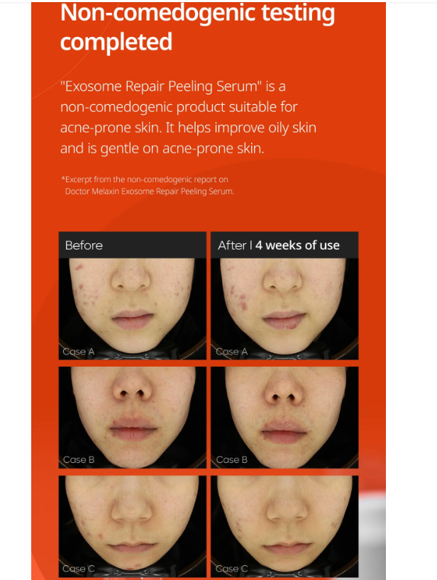 Dr.Melaxin Exosome Repair Peeling Serum 50ml - Image 2
