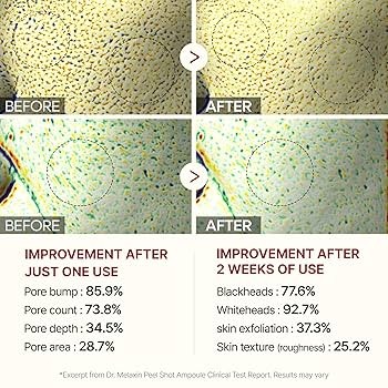 Dr. Melaxin Peel Shot Exfoliating Black Rice Ampoule 80 ml สครับผิวแบบแอมพูล - Image 5