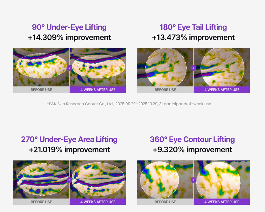 Centellian24 360º Shot PDRN Lifting Eye Cream 30ml - Image 6