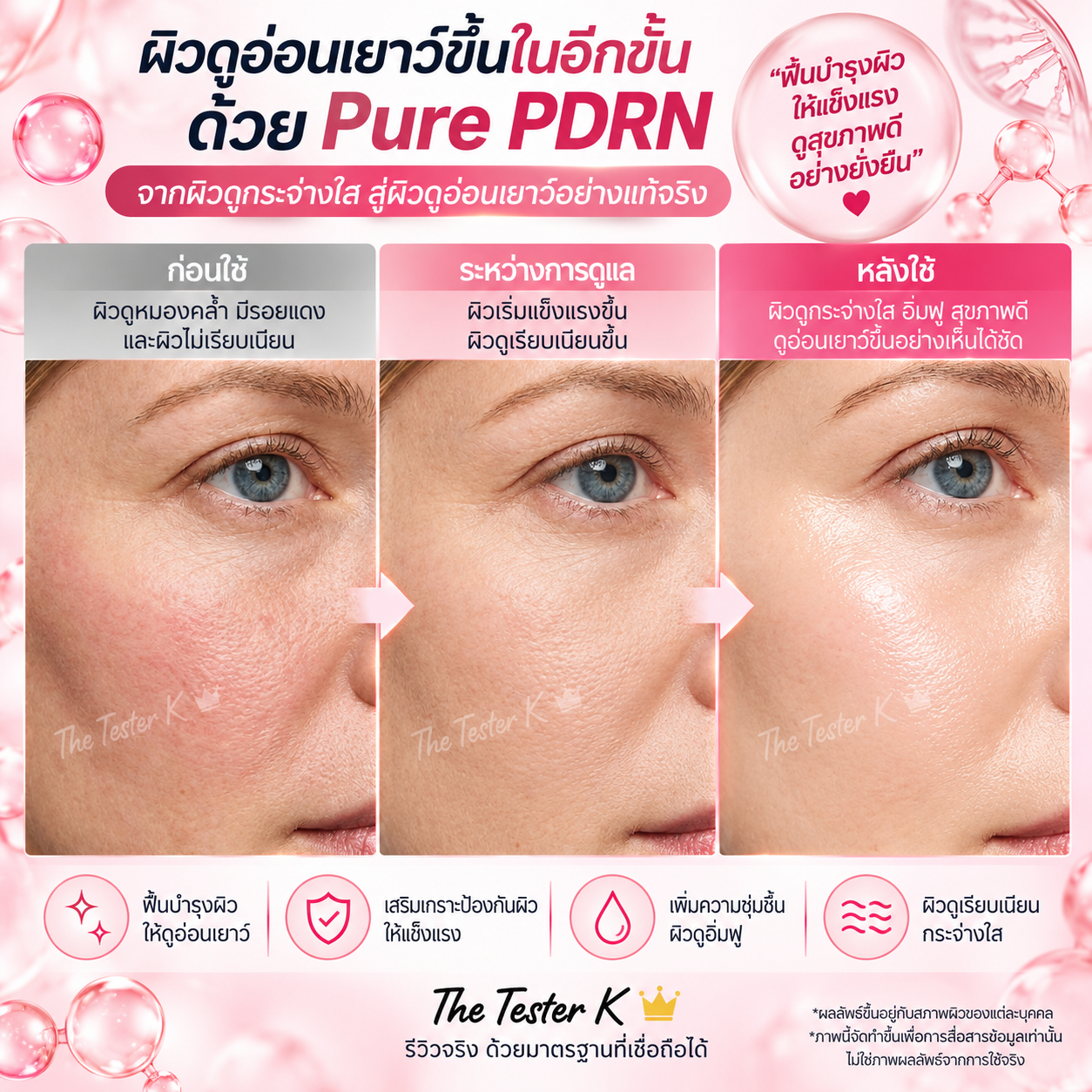 Sungboon Editor PDRN Pink Vitamin Glow Boosting Ampoule 40ml - Image 3